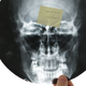 Illustration for article titled The Bizarre History of X-Ray Records and Early Music Piracy